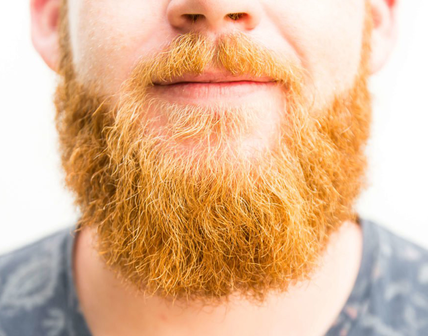 Why's my beard ginger